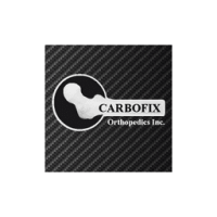 CarboFix Orthopedics Ltd.