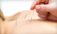 Point del mar acupuncture